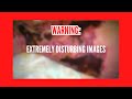 Vibrio vulnificus Infection Awareness