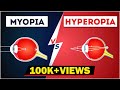 Vision Problems and Lens Corrections