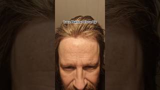 Hair Replacement Lace Hairline Fresh Glue Bond, Close-up Under Bright Light, Bleached Knots