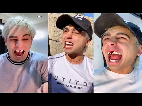 SE FUE EL DIENTE DE MAXZITO 😂 | LOS MAS DIVERTIDOS VIDEOS DE ELMAXZ Y SUS AMIGOS DE TIKTOK