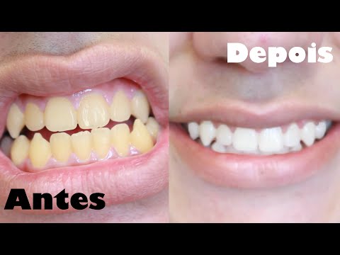 COMO CLAREAR OS DENTES EM 1 MINUTO! RECEITA CASEIRA