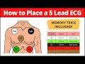 ECG Lead Placement and Mnemonics