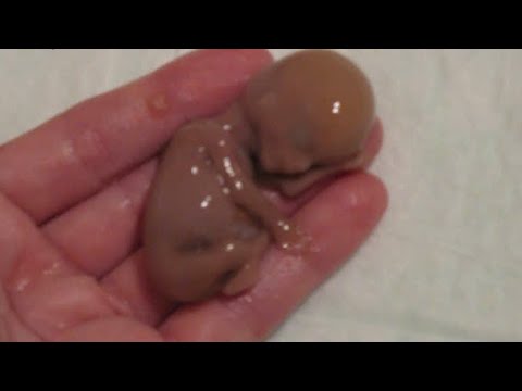 TIẾNG KHÓC CỦA MỘT THAI NHI TRONG KHÁCH SẠN VÀ BÀI HỌC RÚT RA TRONG CUỘC SỐNG.TẠI ĐÀ NẴNG