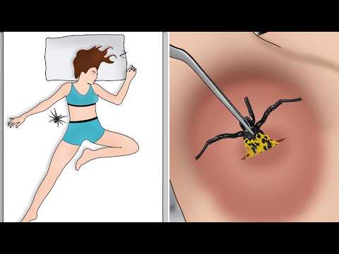 ASMR Remove Dangerous Spider from infected armpit animation