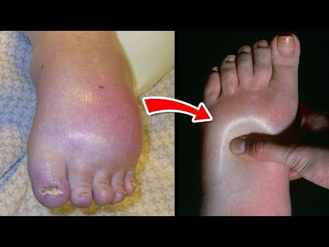Самая Сильная Боль, Которую Может Испытать Человек