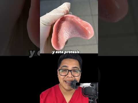 Prótesis de boca económicas #dientes #dentista #tips #parati #viral #fyp #shorts #shortvideo #fypシ