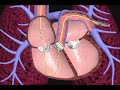 Cardiac Catheterization Techniques and Functions