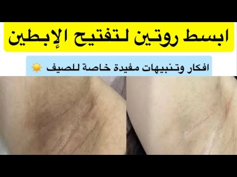 روتين بسيط لتفتيح الإبطين بمنتجات متوفرة ✨ د. هند عناية 