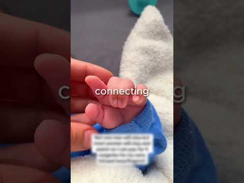 Why are the fingers stuck together?🤔