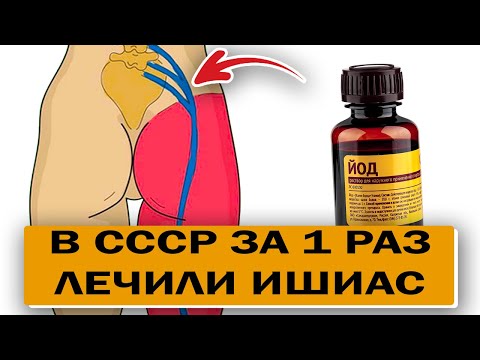 Вот почему в СССР не страдали от ишиаса так, как сейчас