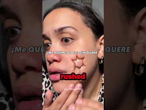 She Never Expected This 😰