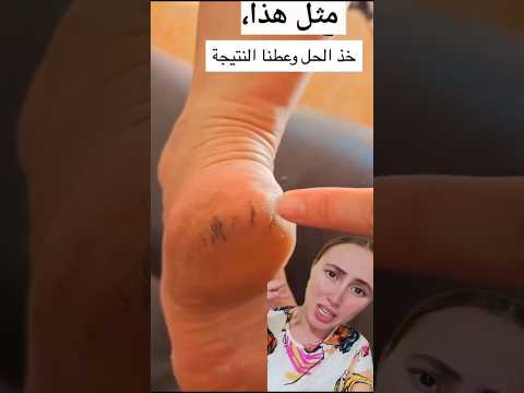 وصفة من أجمل و أحسن الوصفات للأقدام🤤 #explore #trending #اكسبلور #beauty #viral #shorts #short #fyp