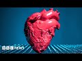 Bioprinting and Organ Transplants