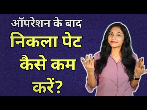 ऑपरेशन के बाद पेट क्यों निकल जाता है | pet kaise kam karen | belly fat loss| how to lose weight fast