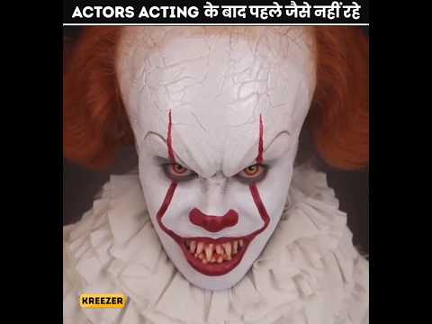 ऐसे Actors जो Acting के बाद पहले जैसे नहीं रहे 😱 | #shorts #acting