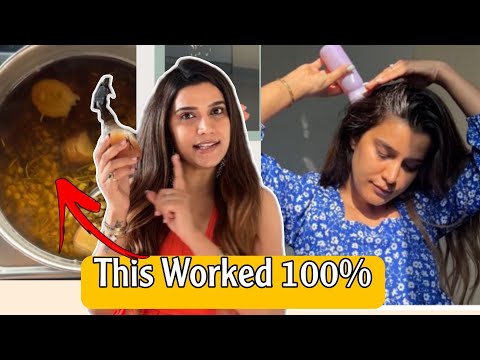 Only This Saved My *HAIR FALL*  | This WORKED 100% | Super Style Tips