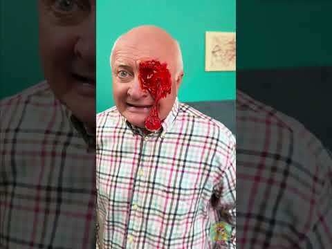 مزحة العين الاصطناعية الواقعية! 😨 كدت أن أفقد الوعي!