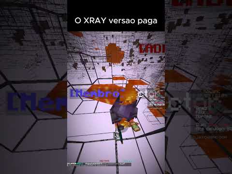 XRAY PAGO...
