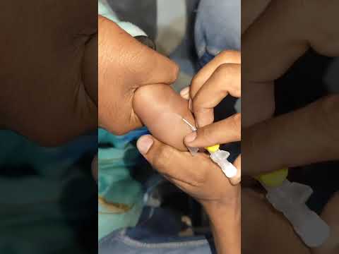IV Cannulation Procedures technique video