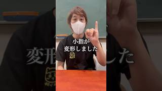 【悲報】指が変形してしまいました