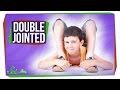 Understanding Hypermobility and Double-Jointedness