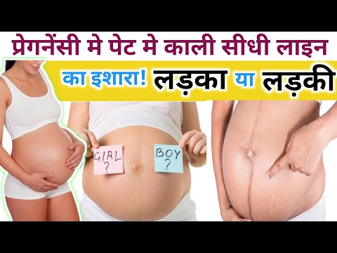 प्रेगनेंसी मे पेट मे काली सीधी लाइन का मतलव लड़का या लड़की क्या होगा?????