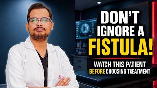 Don't Ignore a Fistula! Watch This Patient Before Choosing Treatment