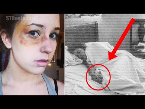 Padres ponen cámaras en el cuarto de su hija para saber por qué despierta con moretones cada mañana