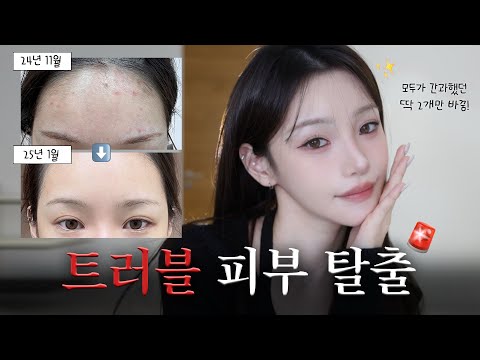 두달만에 건강•튼튼 피부로 바꾼 딱 2가지 비결(w.토리든)🦷 스킨케어 0단계, 음식물 지연성 알러지 검사