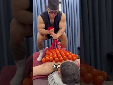 طريقة مجنونة لإزالة أكواب الحجامة… كلّها في ثانية واحدة! 😳