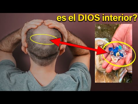 Hallaron Cristales en Cerebros Humanos! ~ (¡Casi Prohibido!)