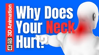 Why Does Your Neck Hurt? Hidden Spinal Causes of Neck Pain Explained