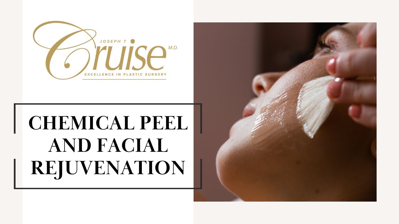 Chemical peel and facial rejuvenation treatment process.