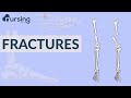 Fracture Treatment and Complications