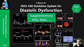 2025 ASE Guideline Update On Diastolic Dysfunction-Part 2