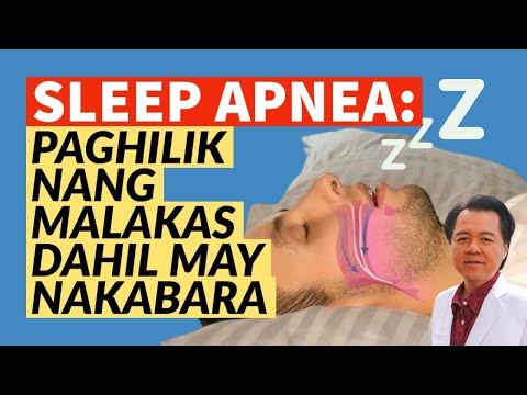 Sleep Apnea: Paghilik ng Malakas Dahil May Nakabara. (Repost Video)