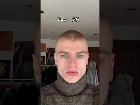 It Won’t Grow Back…