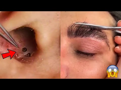 Most Extreme Beauty Treatments 2025 Best Smart and Helpful Beauty Hacks | Virtual Beauty