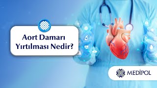 Aort Damarı Genişlemesi Nedir? Aort Damarı Yırtılması Neden Olur?