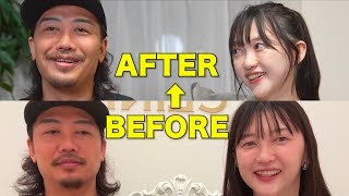 【40歳整形レポ】糸リフトと脂肪吸引で大変なことに…😱😱😱