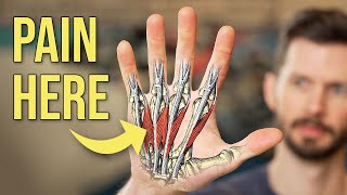 How to Fix Pain from Pocket Climbing & Three Finger Drag (Lumbrical Shift Syndrome)