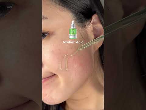 for All breakouts #chxrryglowy #skincare