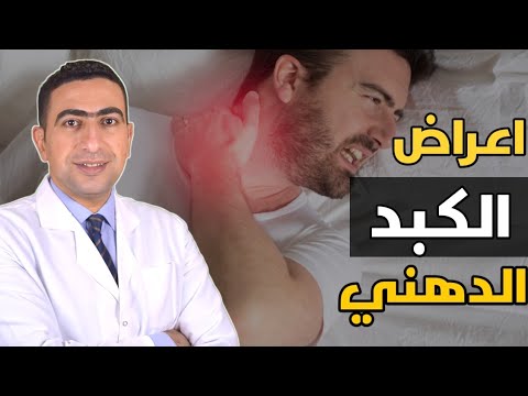 اعراض الكبد الدهني | علامات غريبه تدل علي الاصابه بالكبد الدهني