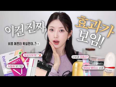 비포애프터 뚜렷한 것들만🫢 돈 안 아까웠던 찐 효능템 8가지! |피부결 좋아진 이유, 효과 쩌는 붓기템, 청담샵 베이스 추천