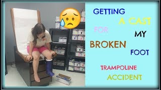 (NURSE MAKING CAST) GETTING A CAST FOR MY BROKEN FOOT - TRAMPOLINE ACCIDENT