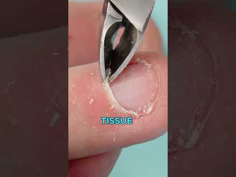 What EXACTLY is the PNF (Proximal Nail Fold ) & Cuticle? 🤷🏻‍♀️