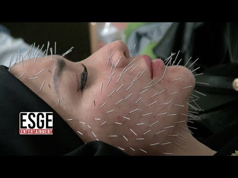 RORO FITRIA JALANI TREATMENT AKUPUNTUR LANDAK