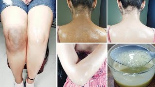 TAN REMOVAL | साबुन नही ये लगाकर नहा लो  पूरे शरीर का कालापन एक बार में खत्म ।