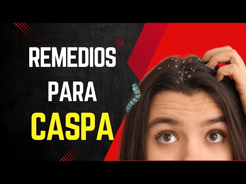 5 Remedios Caseros para la Caspa que REALMENTE Funcionan!