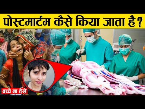 पोस्टमार्टम कैसे किया जाता है ? | पोस्टमार्टम क्या होता है ? | What is Postmortem